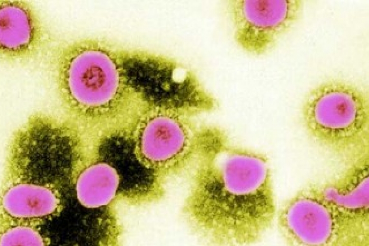 Újabb megbetegedés Franciaországban a tavaly felfedezett koronavírustól